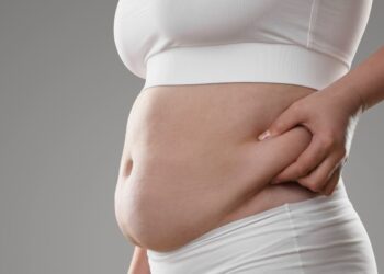 Saiba as melhores cirurgias plásticas para quem está perdendo peso rápido e quer entrar em forma, sem pele sobrando e sem flacidez